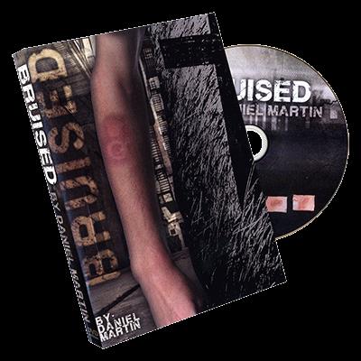 Bruised by Daniel Martin  - Trick